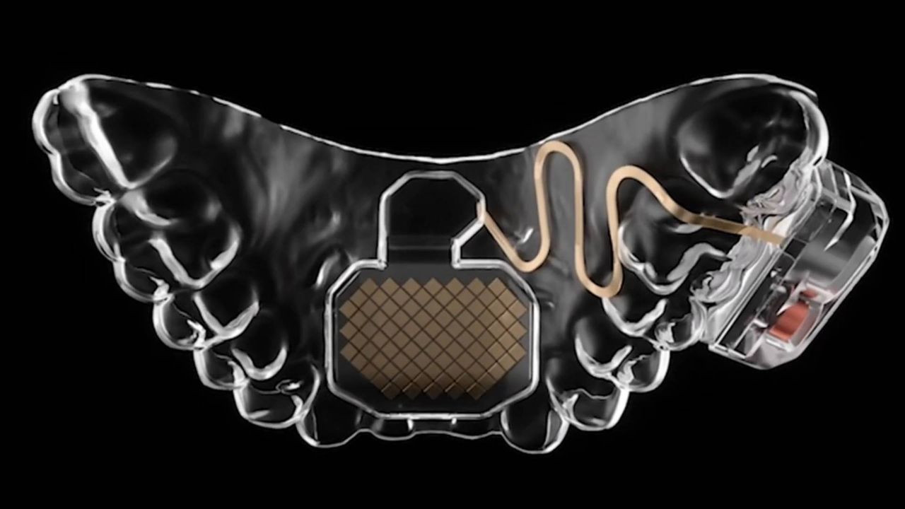 Featured image Control your PC with your tongue using the Mouth Pad